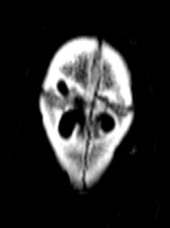 ct scan
