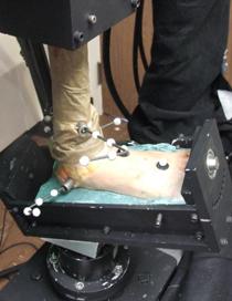 Simulated Ankle Injury due to Torsion