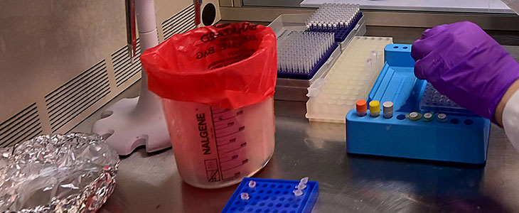 Close up of a student loading samples into a plate before testing as MSU researchers test Covid samples from waste water in Michigan 