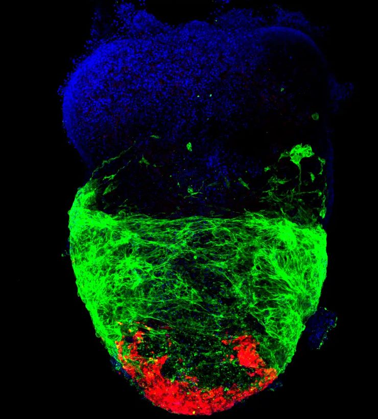 A heart organoid with a well-developed ventricle (green) and cardiac neural crest cells (mCherry) incorporating to the structure. Blue is cell nuclei.