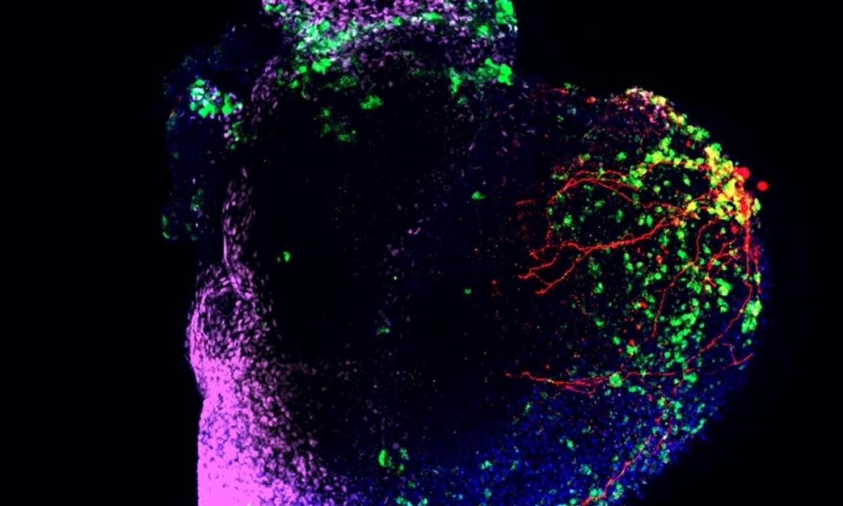 Brightly colored graphic image of a tiny human heart against a black background.