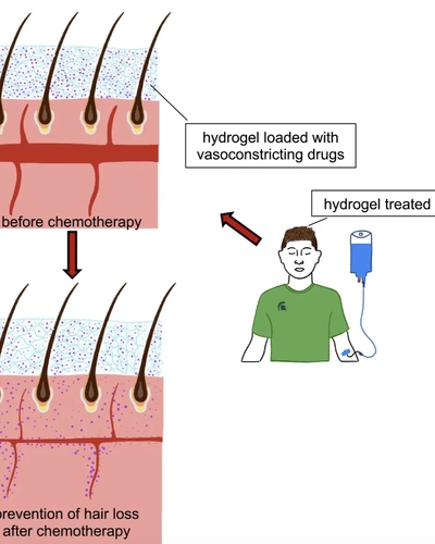 cancer-hair-gel2
