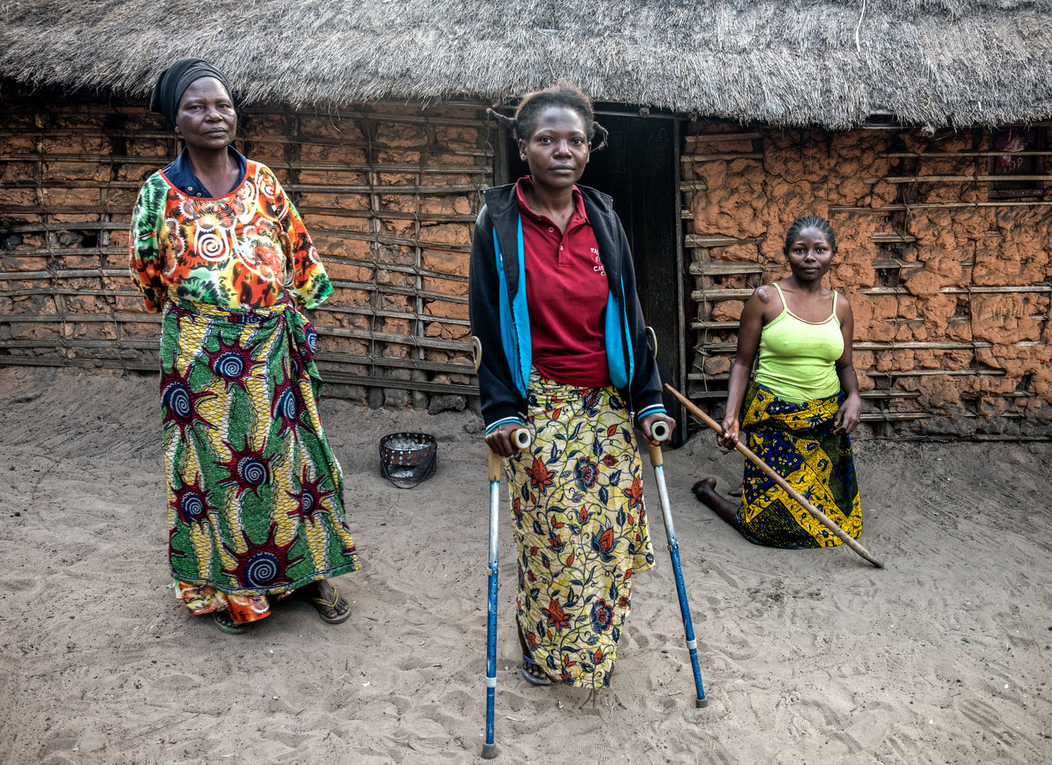 African women affected by Konzo disease in DR Congo.