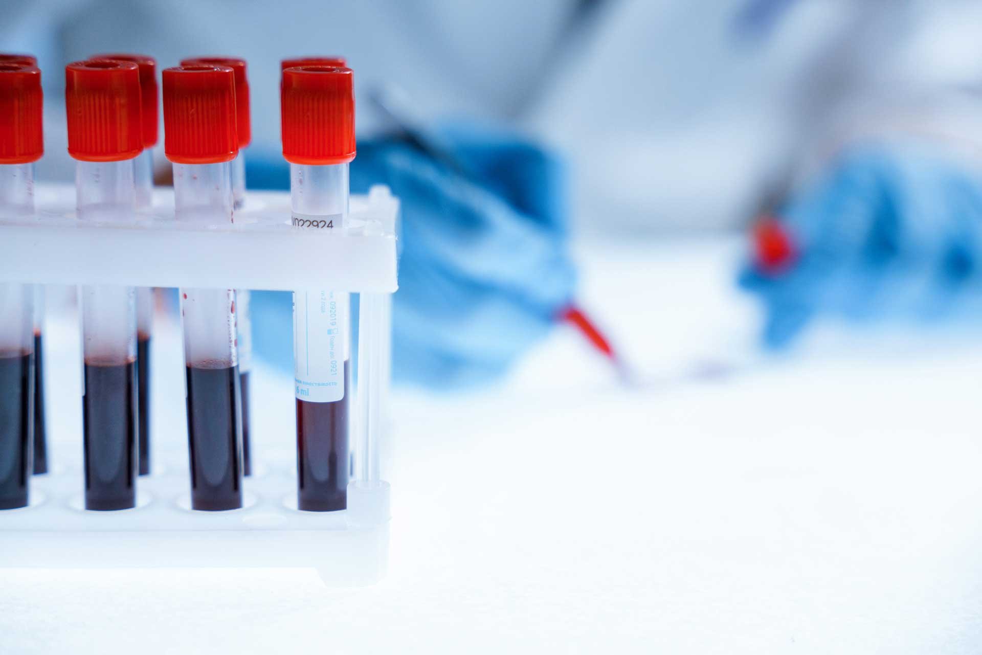 blood-samples-GettyImages-1389312701-1920x1281