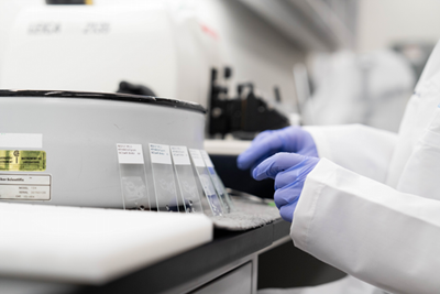 159160_Pancreatic_0009_600x400