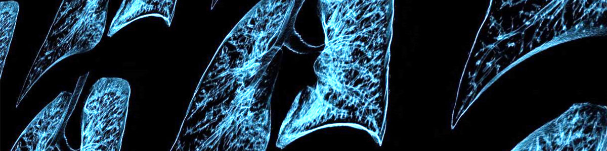 Lung scan images.