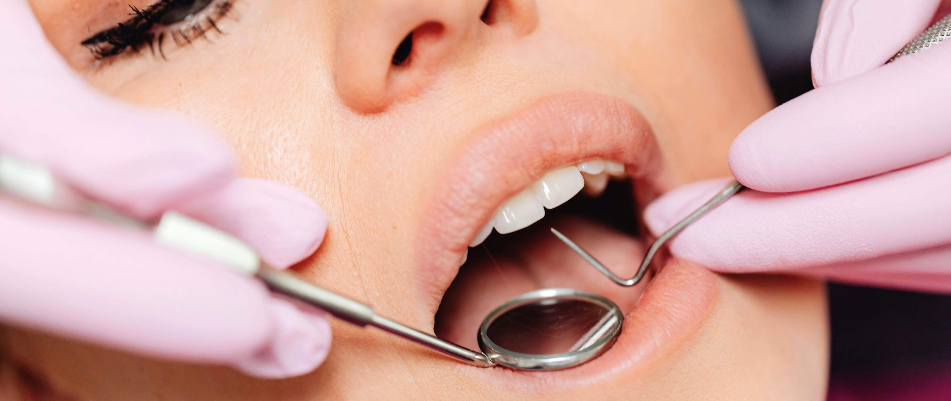 O Dental