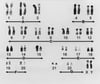 Chromosomes