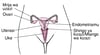 Anatomia ya Ndani ya Uzazi ya Mwanamke