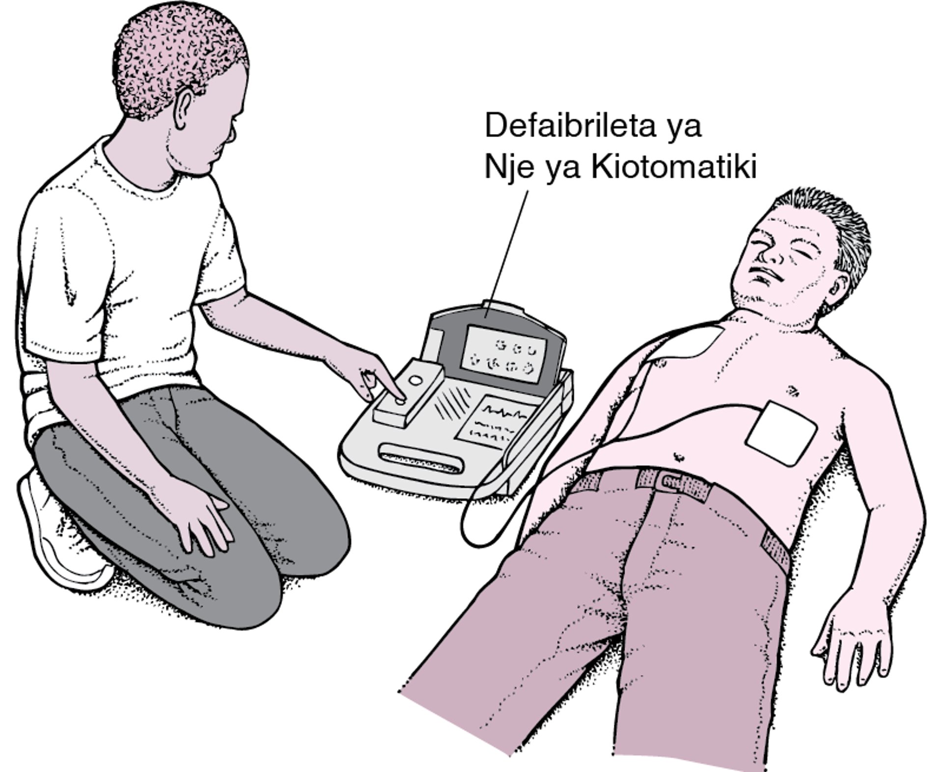 Defaibrileta ya Nje ya Kiotomatiki: Kuanzisha Moyo Upya