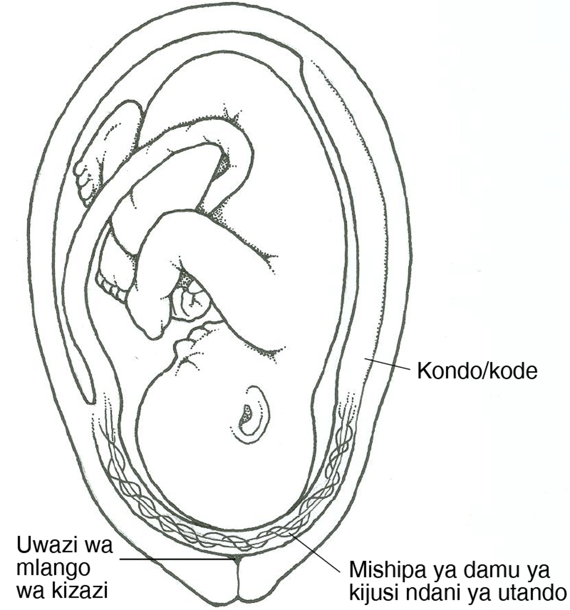 Je, Tatizo la Kondo la Nyuma Kufunga Njia ya Kutokea Mtoto ni nini?