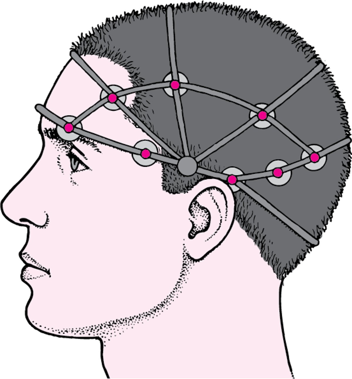 EEG