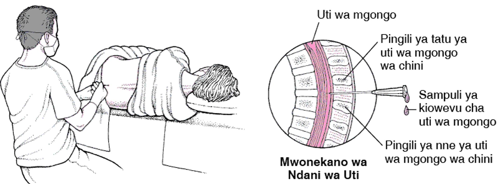 Kinga Majimaji ya Uti wa Mgongo