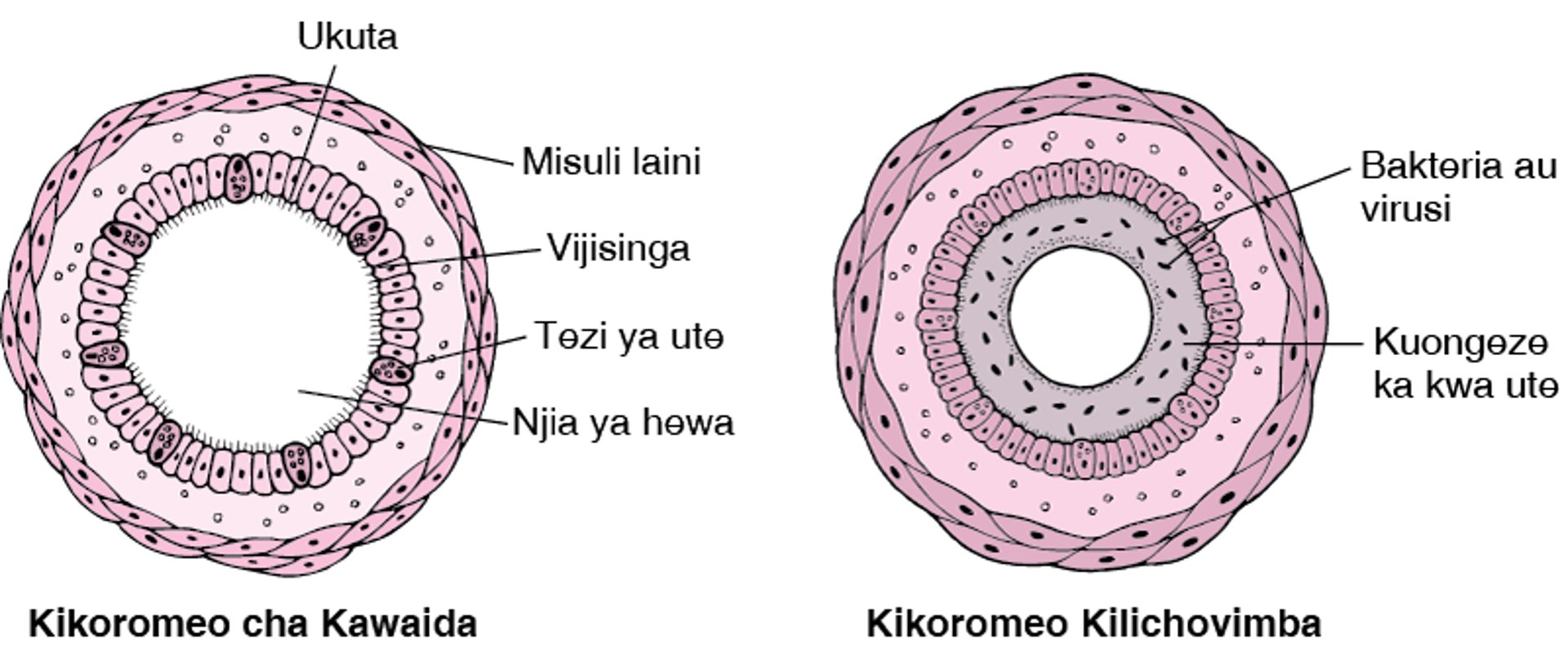 Bronkoskopi