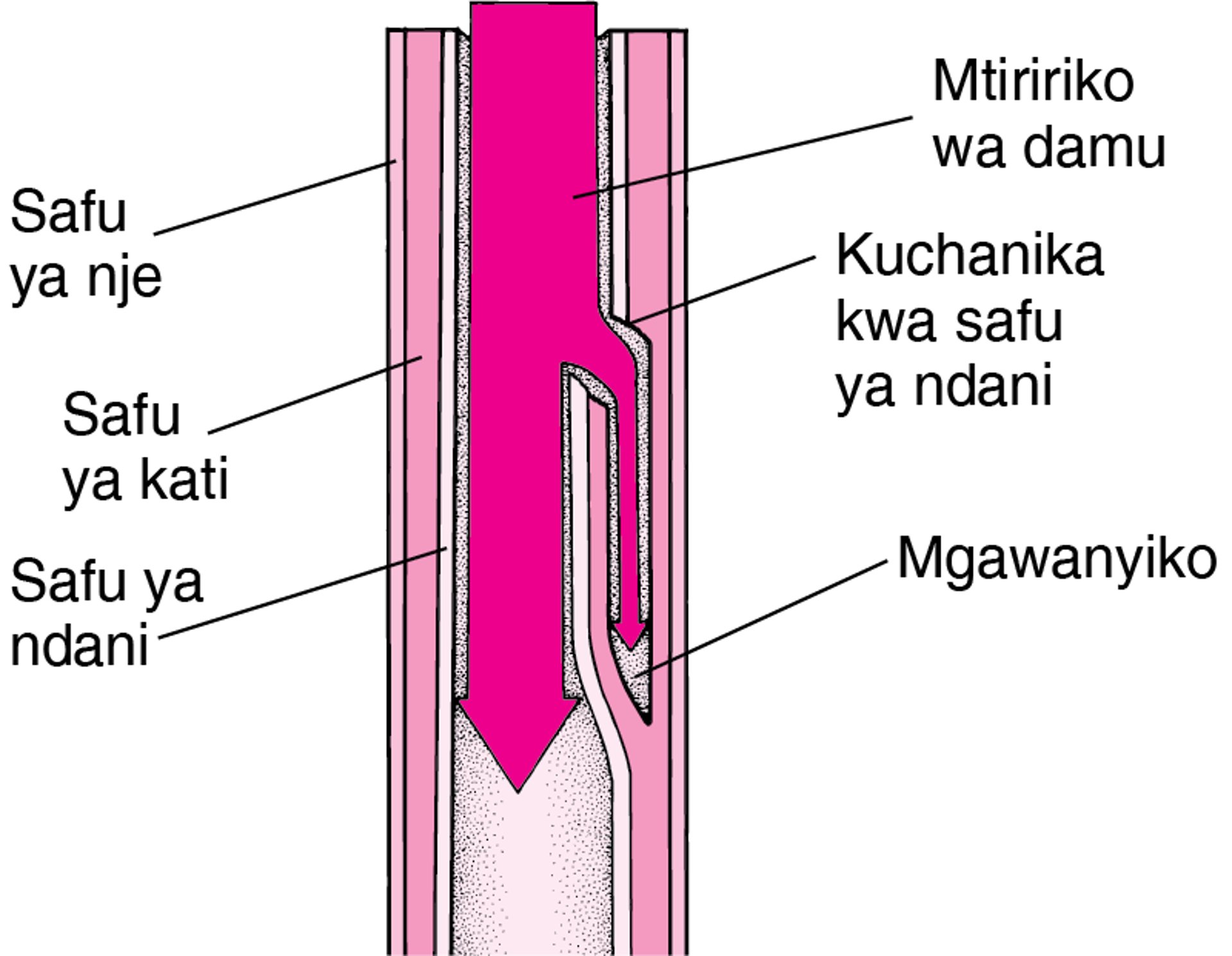 Kuelewa Mgawanyiko wa Mkole