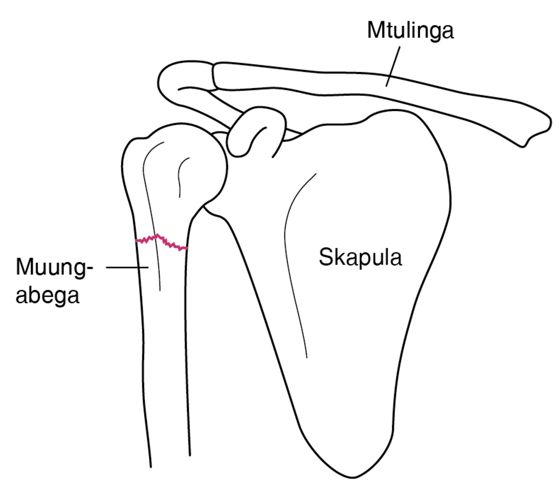 Mvunjiko wa bega
