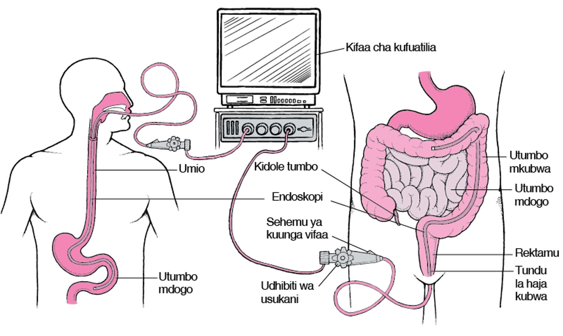 Kuangalia Mfumo wa Umeng’enyaji kwa Kutumia Endoskopi