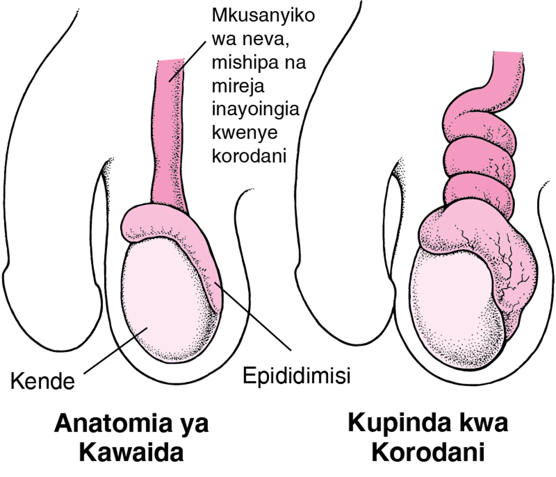 Kusokotwa kwa Korodani ni Nini?