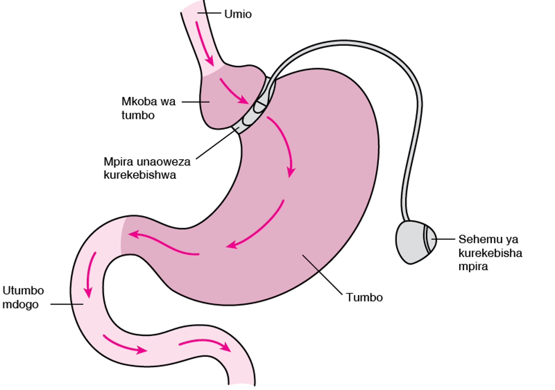 Kupunguza Chakula Kinachoingia Tumboni