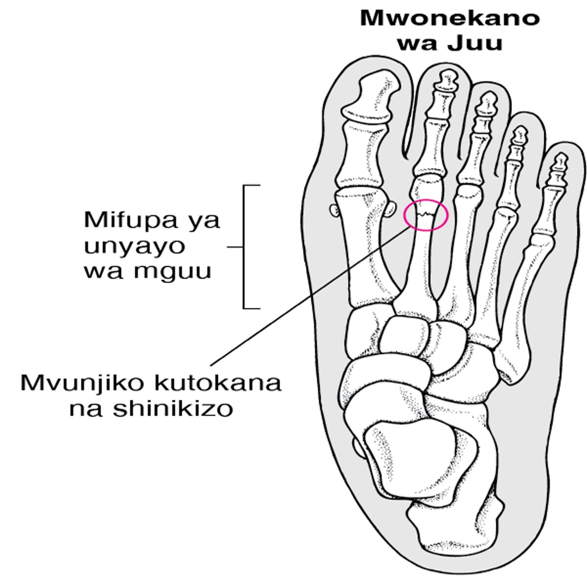 Mvunjiko wa Mkazo ni nini?