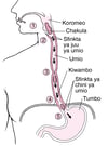 Jinsi Umio Inavyofanya Kazi