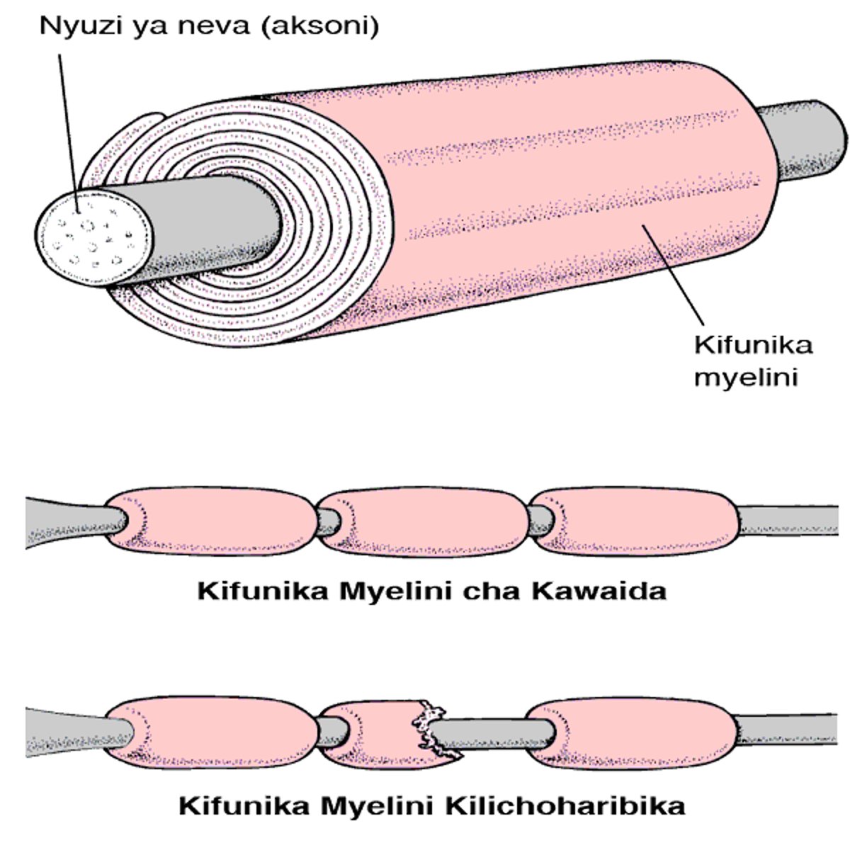 Kufunika Nyuzi ya Neva