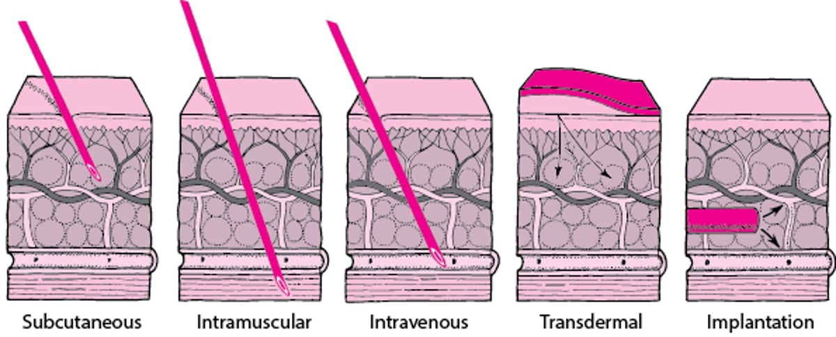 Kupitia kwenye Ngozi