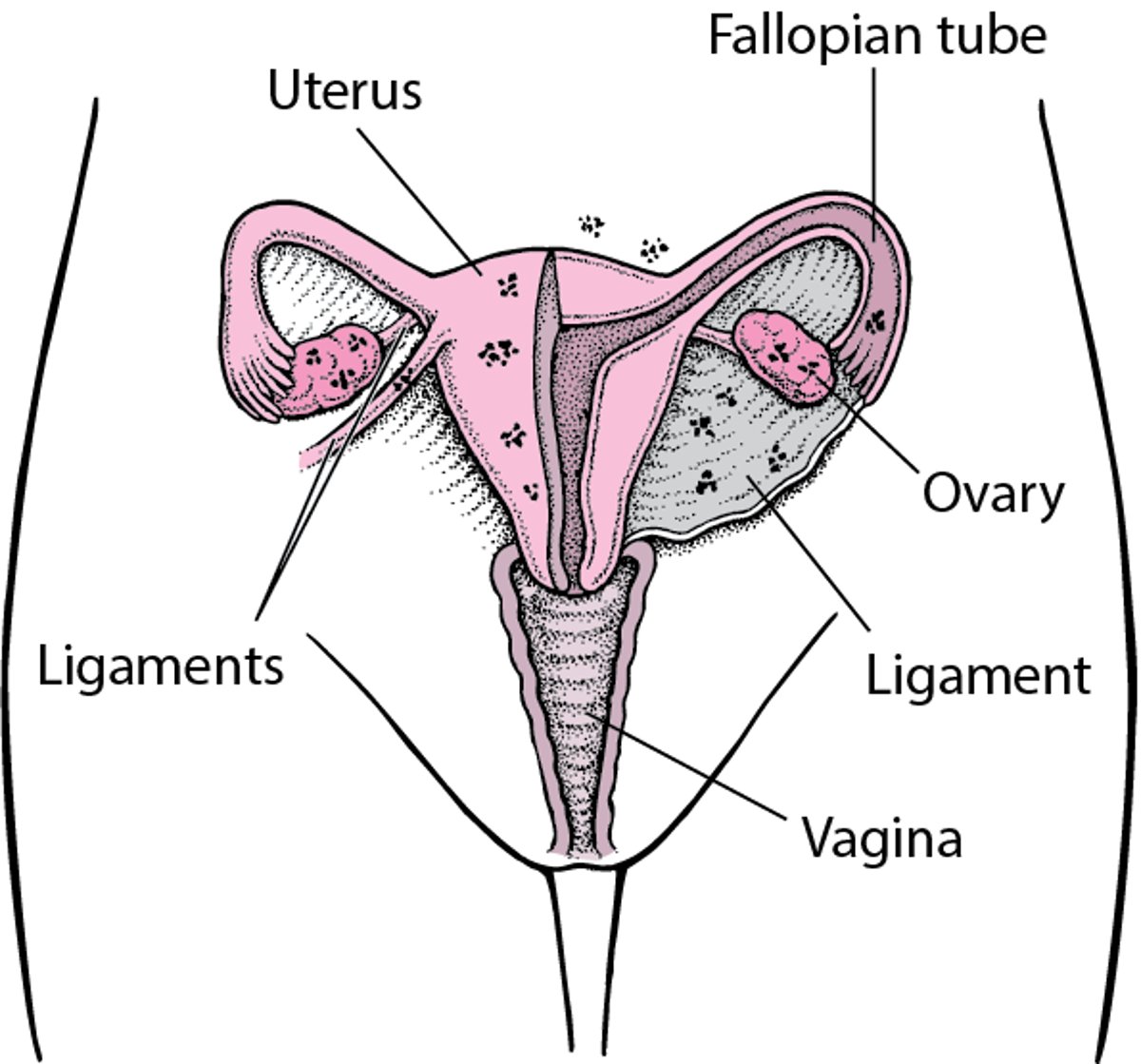 Endometriosis: Tishu Isiyo Mahali Pake