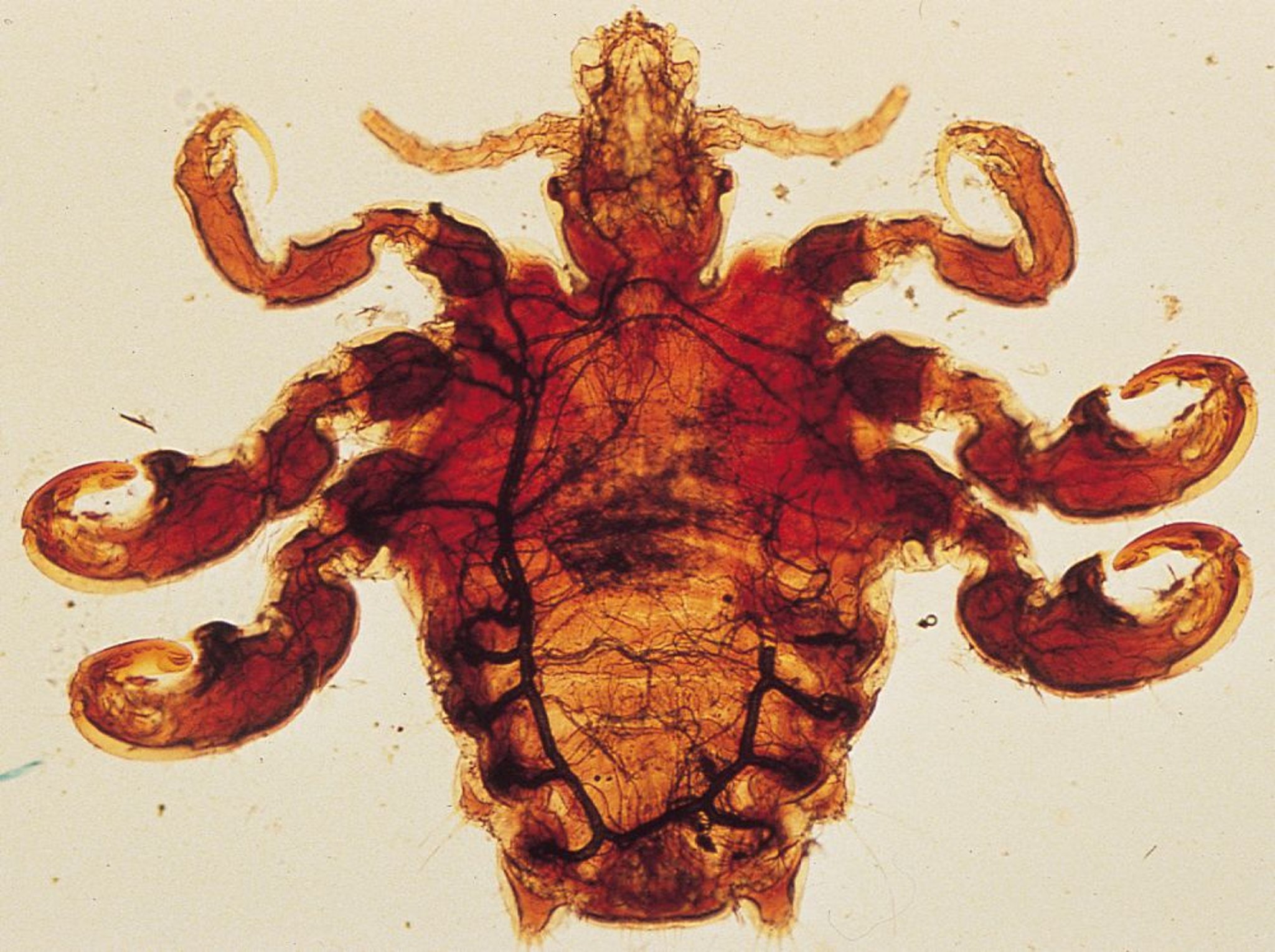 Close-Up Photo of a Pubic Louse