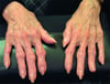 Bouchard-Knoten