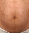Linea nigra