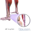 تمزُّق العرقُوب (وتَر أخيل)