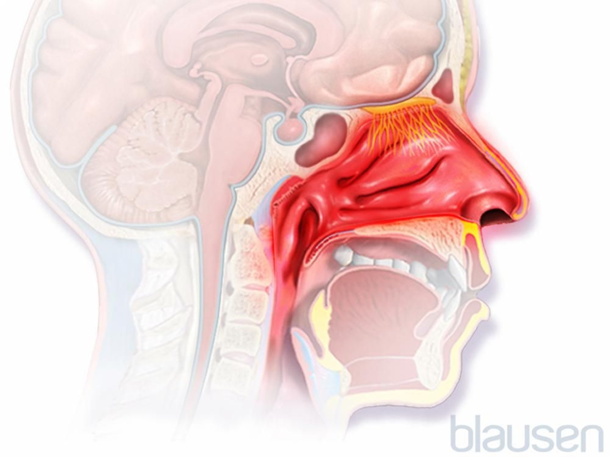 Allergic Rhinitis