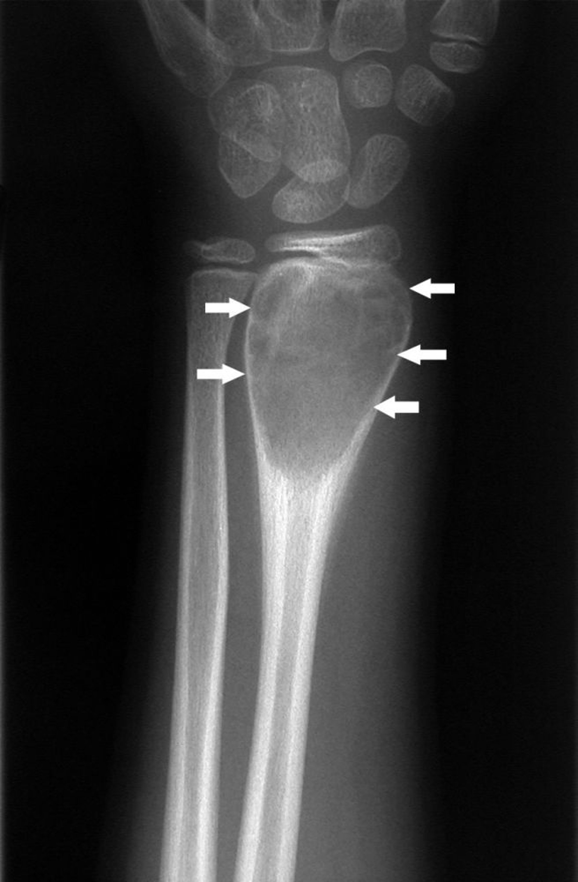Radiographie du poignet