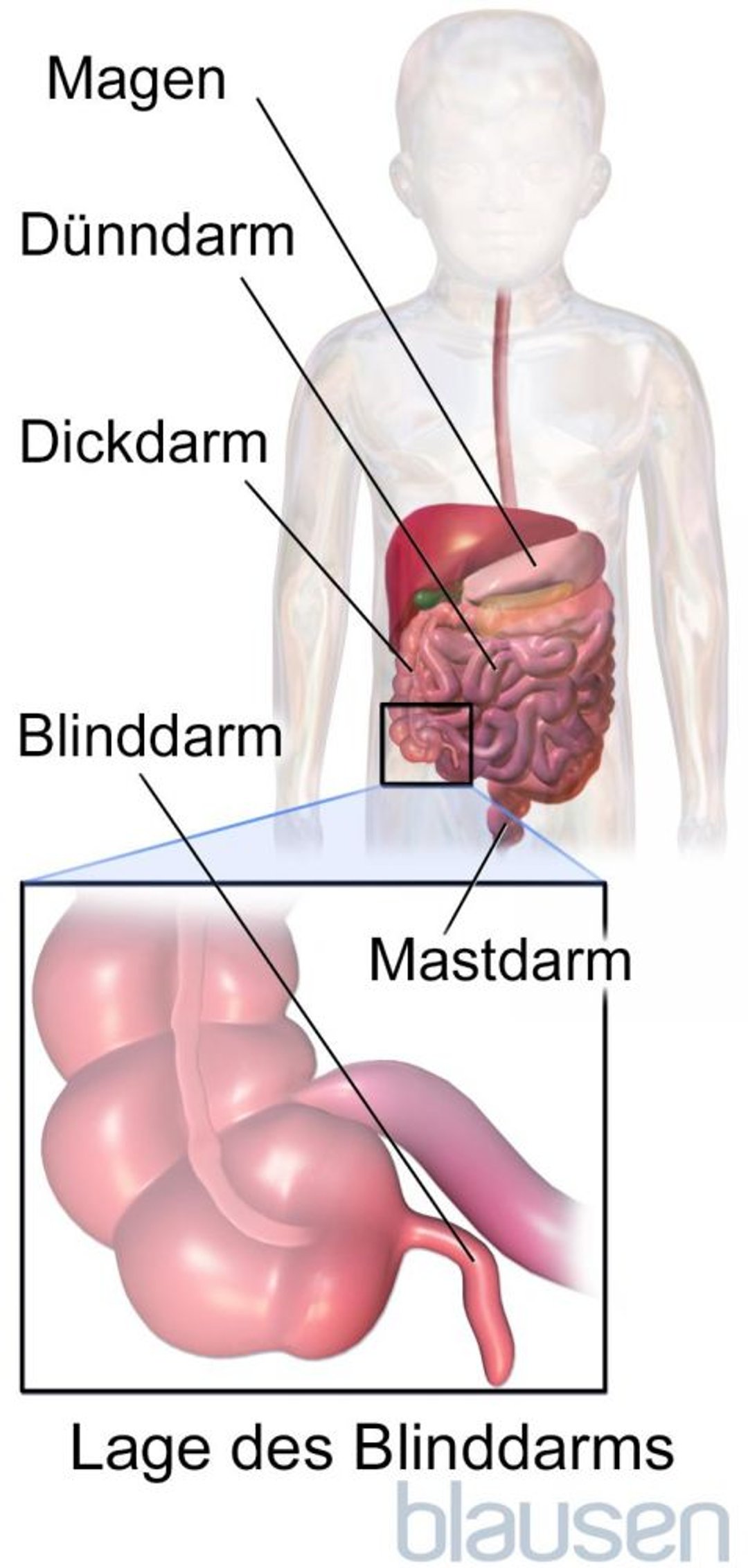 Lage des Blinddarms