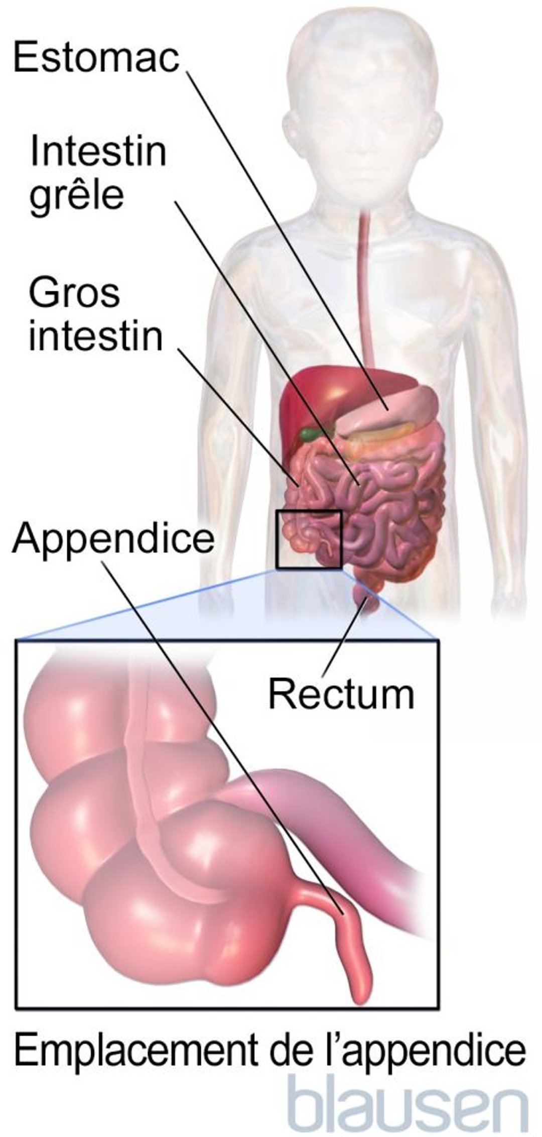 Emplacement de l’appendice