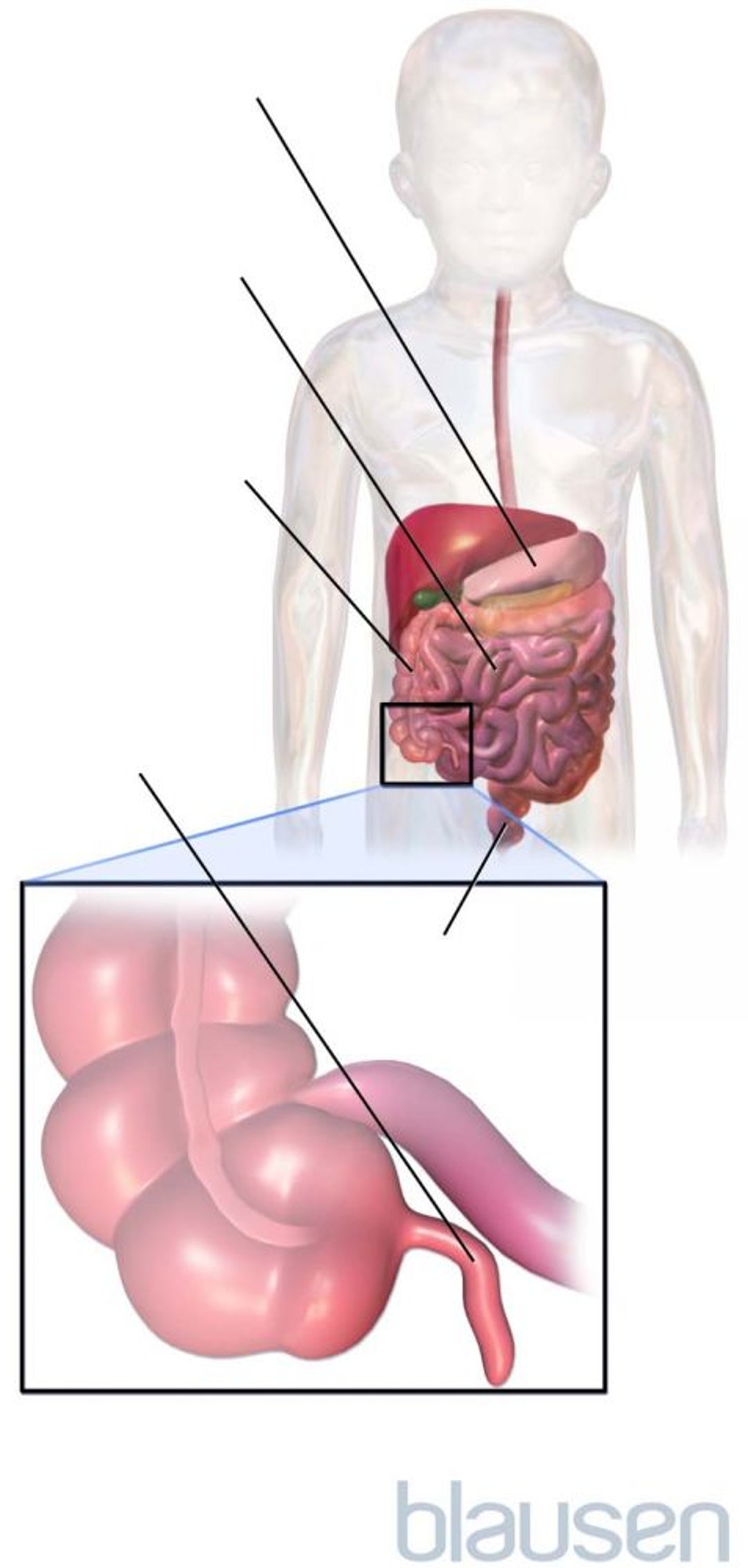 अपेंडिक्स का स्थान