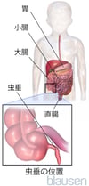 虫垂ちゅうすいの位置いち
