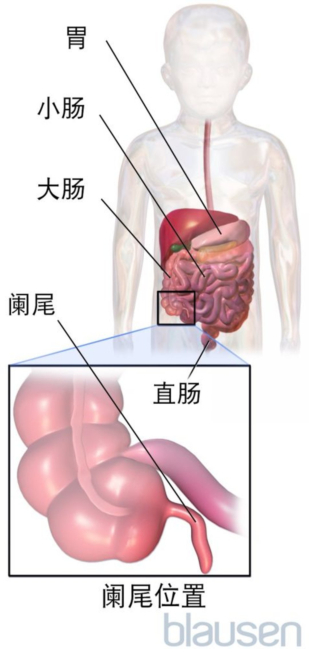 阑尾位置