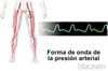Onda arterial