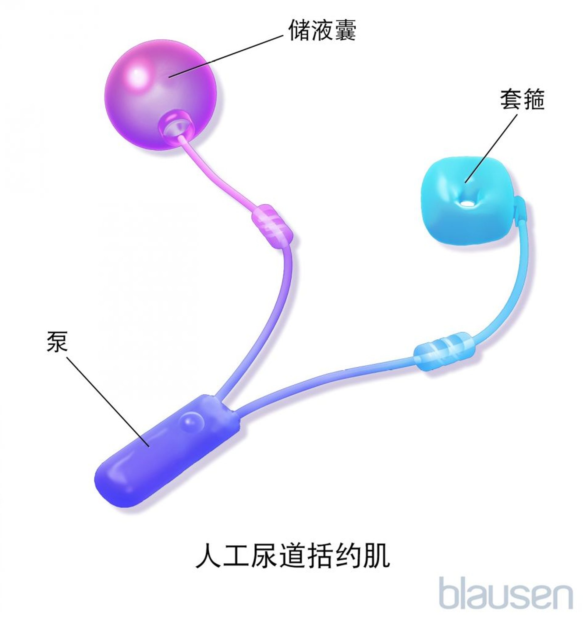 人工尿道括约肌