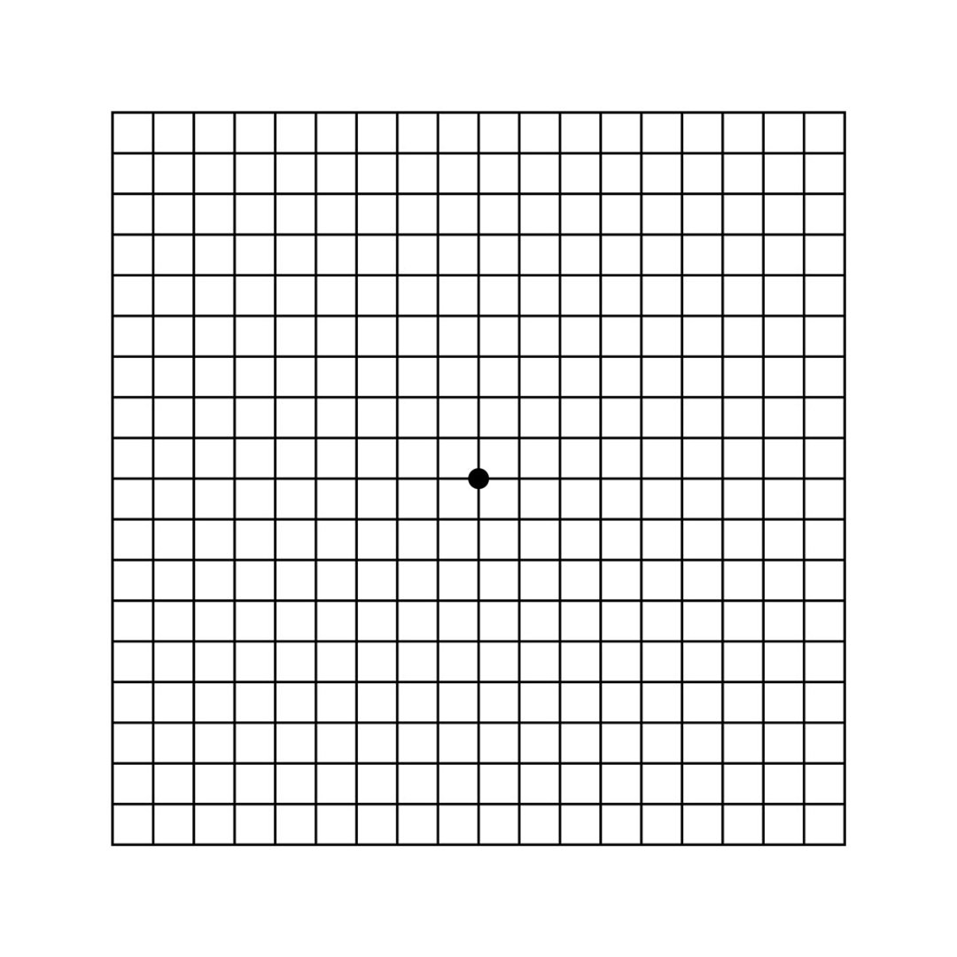 Age-Related Macular Degeneration (AMD or ARMD) - Eye Disorders - Merck ...