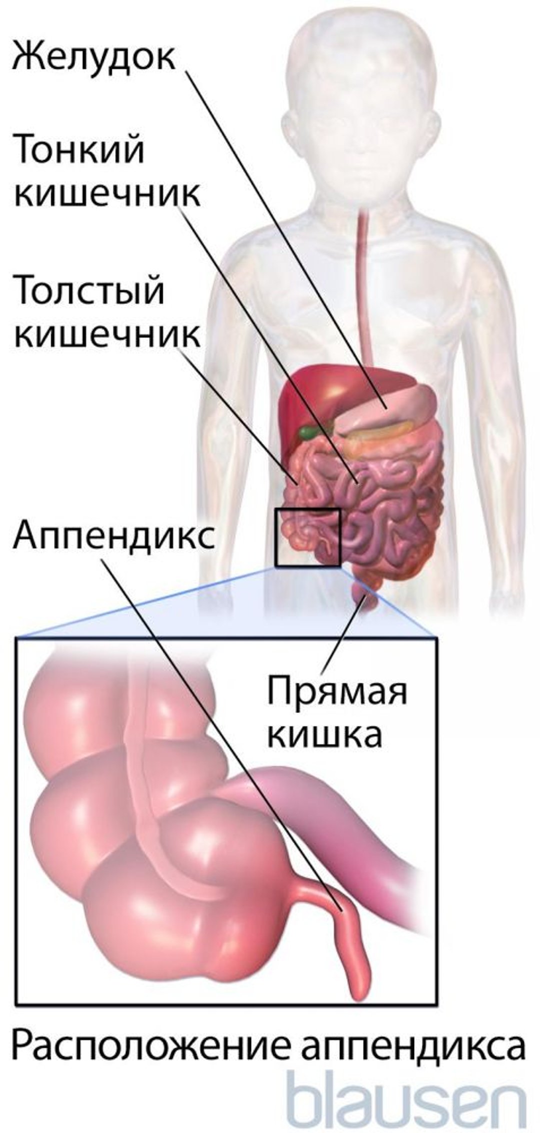 Расположение аппендикса