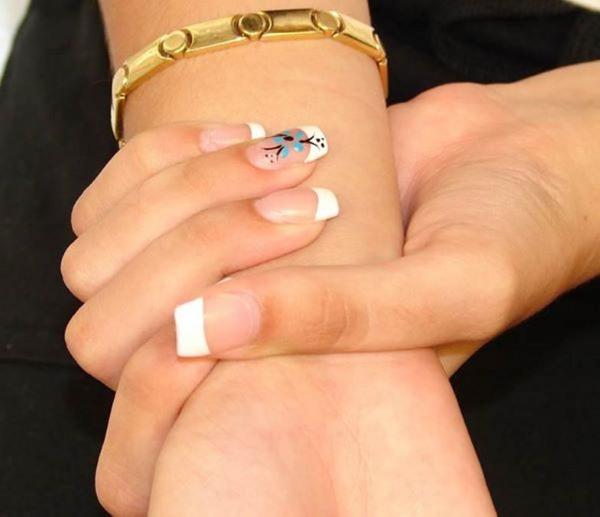 Синдром Марфана (длинные пальцы)