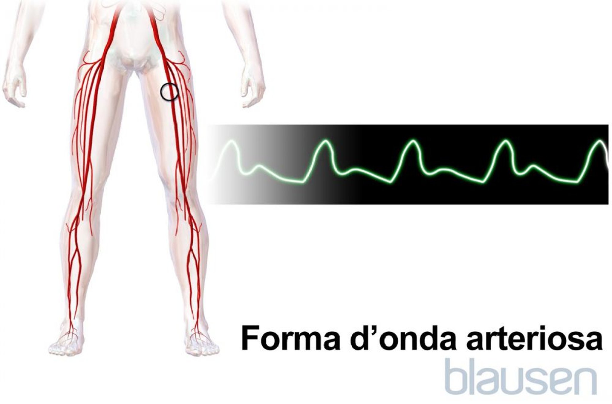Forma d’onda arteriosa