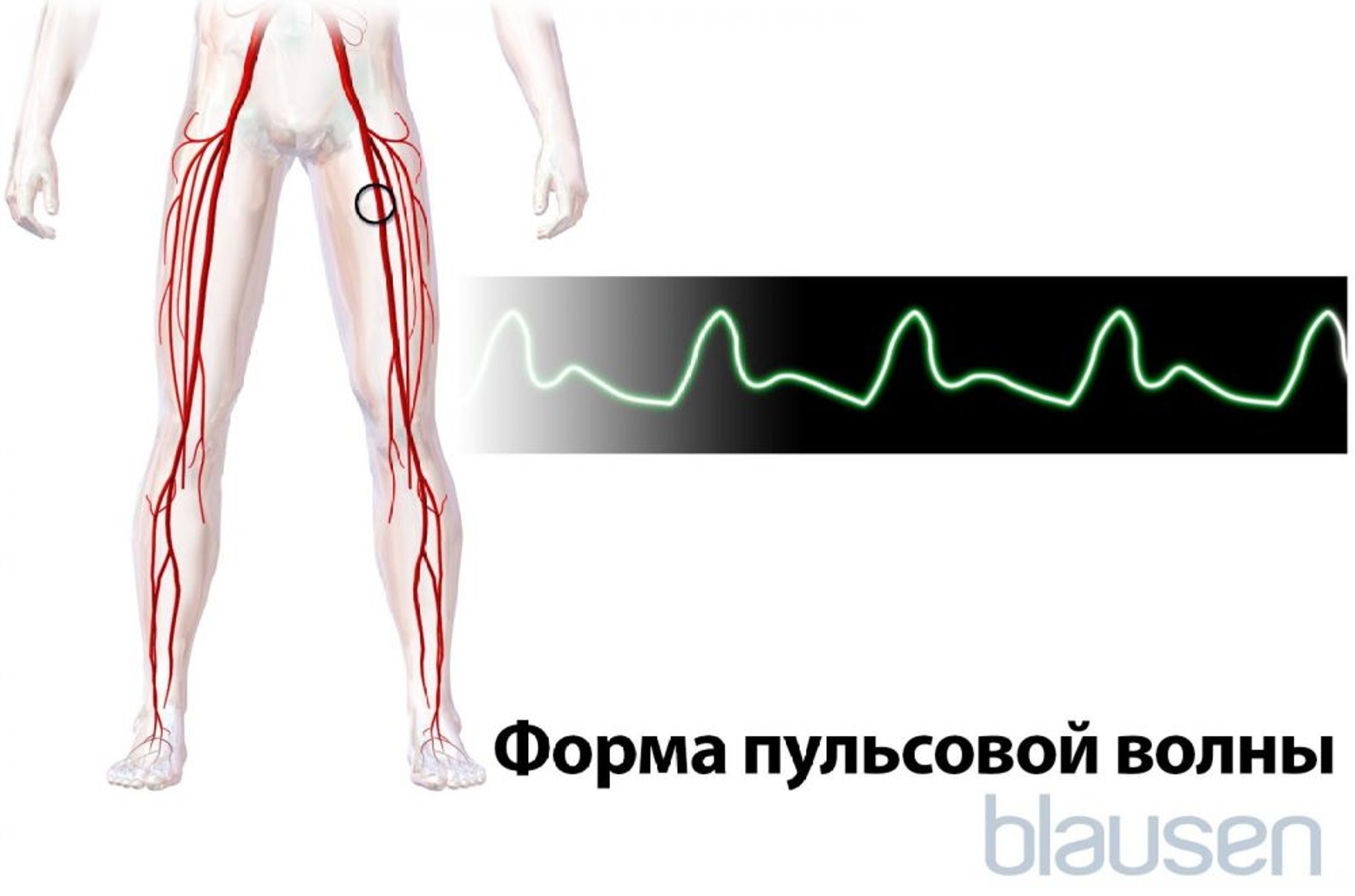 Форма пульсовой волны