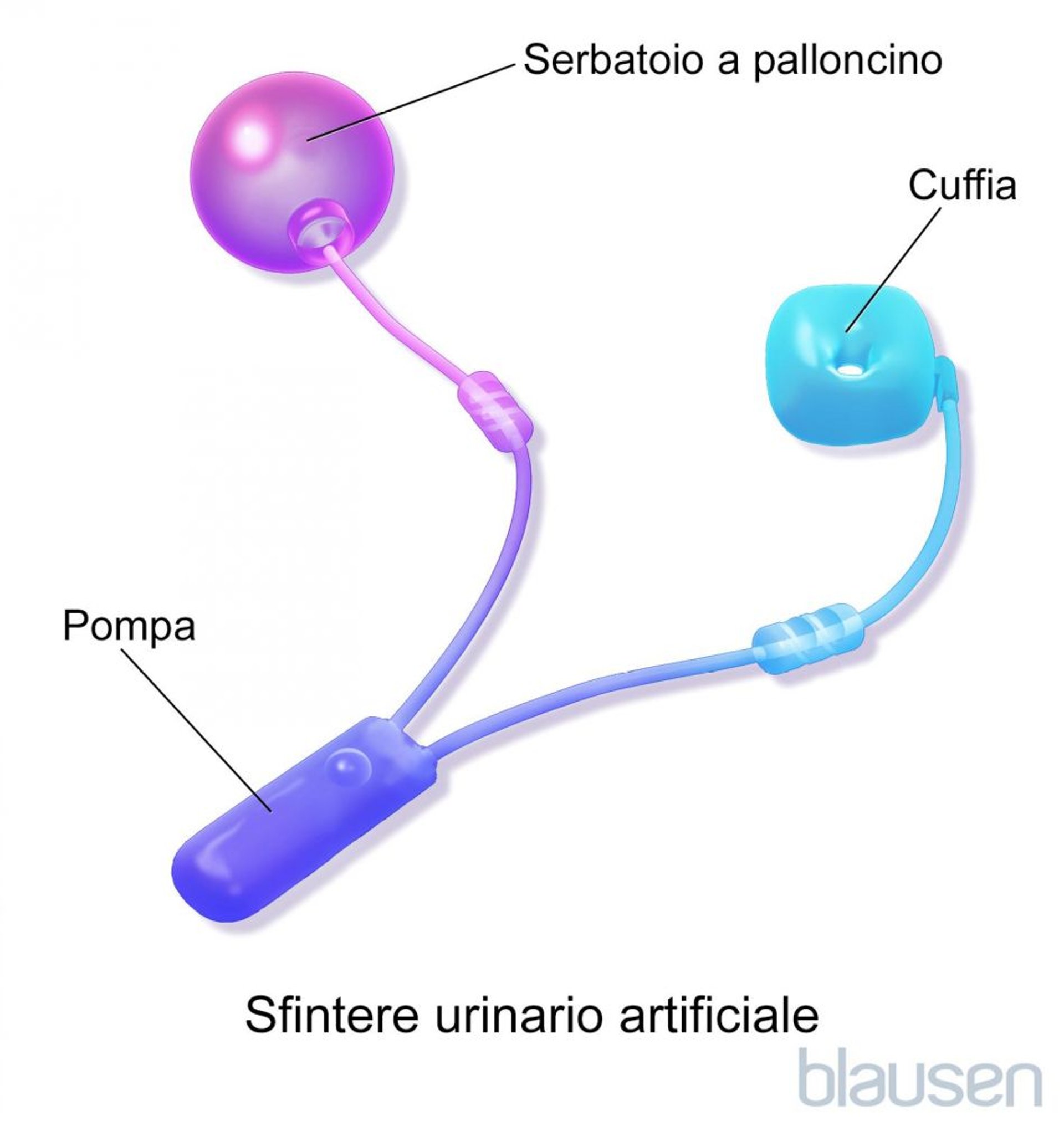 Sfintere urinario artificiale