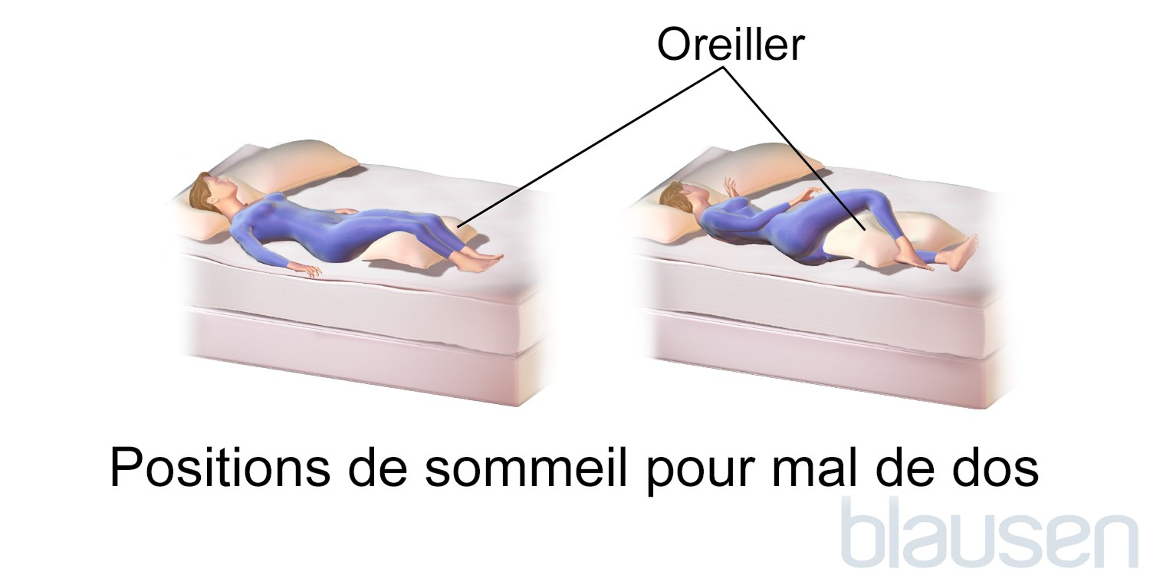 Positions pour dormir en cas de douleur dorsale