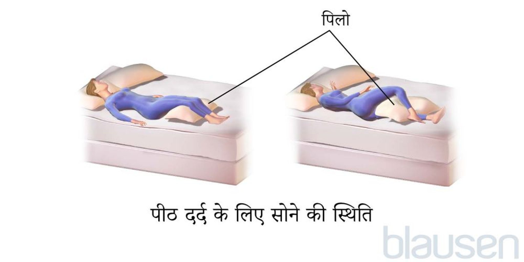 पीठ दर्द के लिए सोने की स्थिति