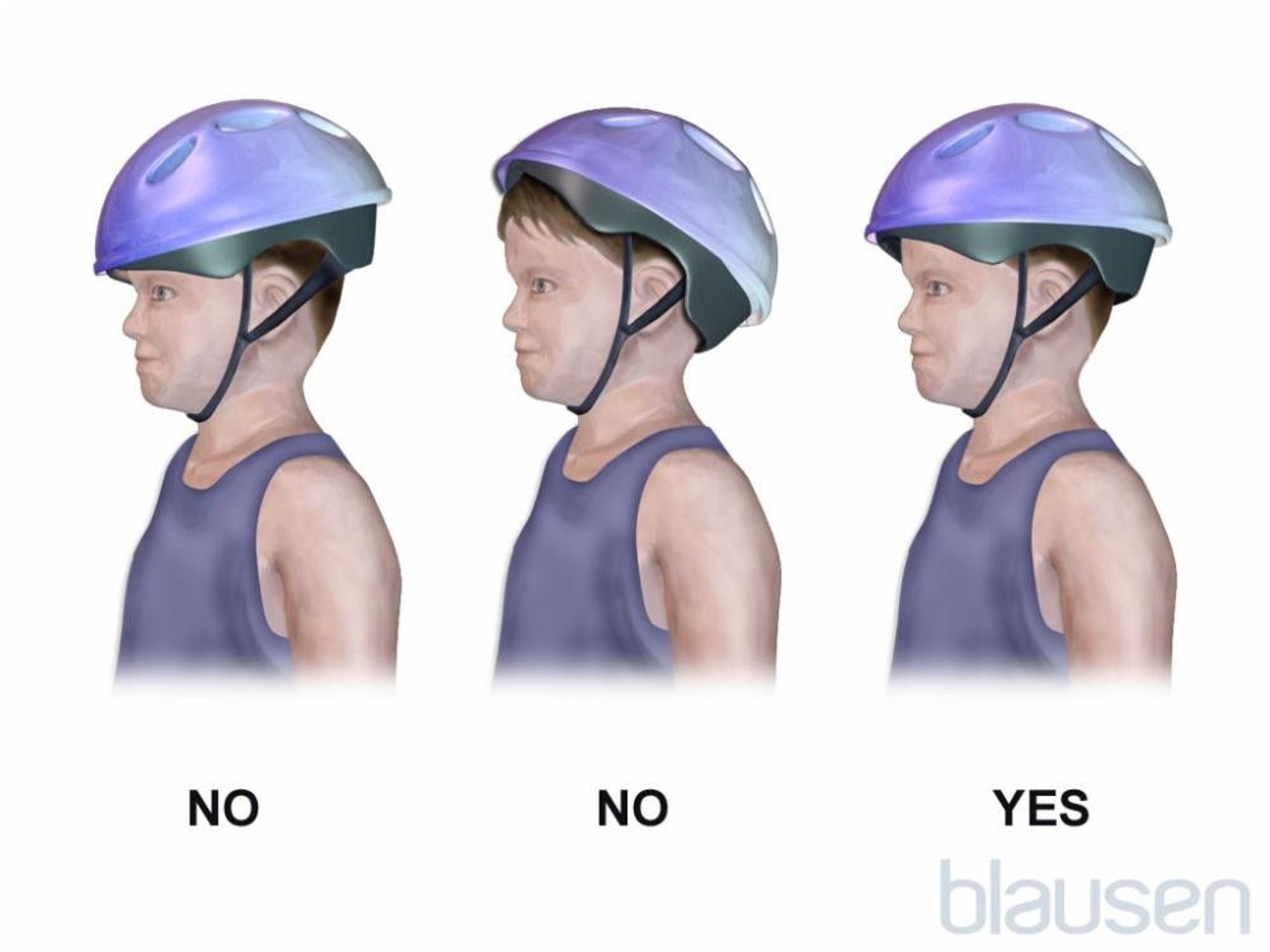 Correct Placement of a Child's Bicycle Helmet